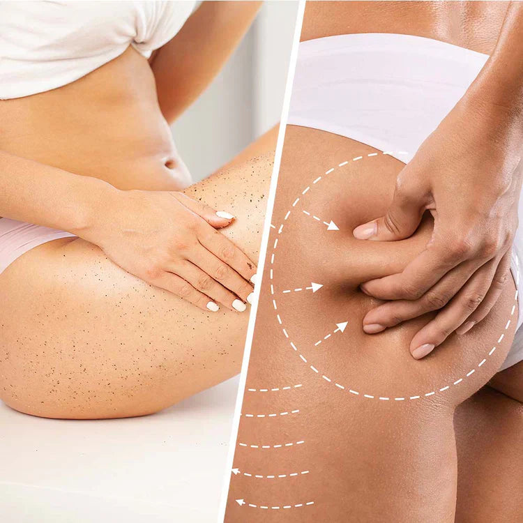 Niacin scrub κατά της κυτταρίτιδας με καρύδα για σύσφιξη και λείανση του δέρματος 250 ml