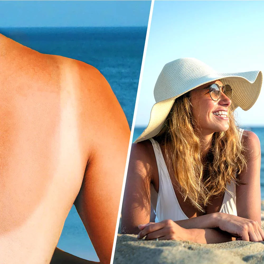 Καταπραϋντικό ψεκασμό λοσιόν με υαλουρονικό οξύ μετά τον ήλιο - 200 mL